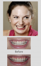 Cosmetic Dentist Perth