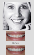 Cosmetic Dentists Perth